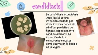 candidiasis
La candidiasis (candidosis
,moniliasis) es una
infección causada por
diversas variedades de
cándida, parásitos de
hongos, especialmente
cándida albicans. La
infección de las
membranas mucosas,
como ocurre en la bosa o
en la vagina.
 