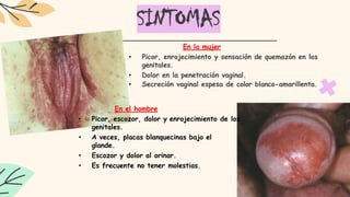 SINTOMAS
En la mujer
• Picor, enrojecimiento y sensación de quemazón en los
genitales.
• Dolor en la penetración vaginal.
• Secreción vaginal espesa de color blanco-amarillenta.
En el hombre
• Picor, escozor, dolor y enrojecimiento de los
genitales.
• A veces, placas blanquecinas bajo el
glande.
• Escozor y dolor al orinar.
• Es frecuente no tener molestias.
 