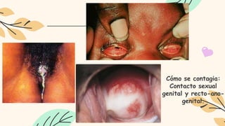Cómo se contagia:
Contacto sexual
genital y recto-ano-
genital.
 