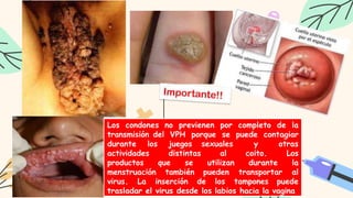 Los condones no previenen por completo de la
transmisión del VPH porque se puede contagiar
durante los juegos sexuales y otras
actividades distintas al coito. Los
productos que se utilizan durante la
menstruación también pueden transportar al
virus. La inserción de los tampones puede
trasladar el virus desde los labios hacia la vagina
 