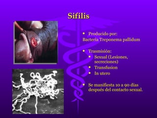 Sifilis Producido por: Bacteria Treponema pallidum Trasmisión: Sexual (Lesiones, secreciones) Transfusion In utero Se manifiesta 10 a 90 días después del contacto sexual. 