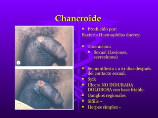 Chancroide Producido por: Bacteria Haemophilus ducreyi Trasmisión: Sexual (Lesiones, secreciones) Se manifiesta 1 a 21 días después del contacto sexual. SyS: Ulcera NO INDURADA DOLOROSA con base friable. Ganglios regionales Sifilis – Herpes simplex -  