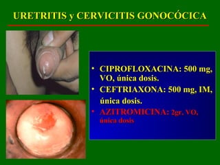 URETRITIS y CERVICITIS GONOCÓCICA




             • CIPROFLOXACINA: 500 mg,
               VO, única dosis.
             • CEFTRIAXONA: 500 mg, IM,
               única dosis.
             • AZITROMICINA: 2gr, VO,
              única dosis
 