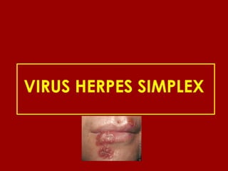 VIRUS HERPES SIMPLEX
 