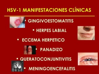 HSV-1 MANIFESTACIONES CLÍNICAS

       GINGIVOESTOMATITIS

          HERPES LABIAL

    ECCEMA HERPETICO

           PANADIZO

    QUERATOCONJUNTIVITIS

      MENINGOENCEFALITIS
 
