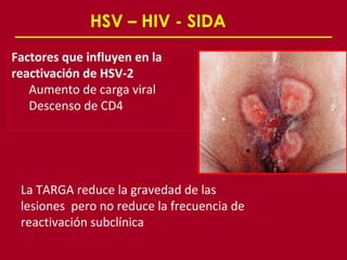 HSV – HIV - SIDA
Factores que influyen en la
reactivación de HSV-2
   Aumento de carga viral
   Descenso de CD4




 La TARGA reduce la gravedad de las
 lesiones pero no reduce la frecuencia de
 reactivación subclínica
 