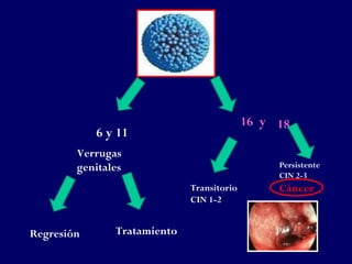 16 y 18
            6 y 11
        Verrugas
        genitales                               Persistente
                                                CIN 2-3
                             Transitorio        Cáncer
                             CIN 1-2


Regresión      Tratamiento
 