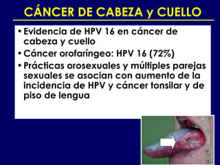 CÁNCER DE CABEZA y CUELLO
• Evidencia de HPV 16 en cáncer de
  cabeza y cuello
• Cáncer orofaríngeo: HPV 16 (72%)
• Prácticas orosexuales y múltiples parejas
  sexuales se asocian con aumento de la
  incidencia de HPV y cáncer tonsilar y de
  piso de lengua
 