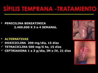 SÍFILIS TEMPRANA -TRATAMIENTO

 PENICILINA BENZATINICA
       2.400.000 X 3 o 4 SEMANAL



   ALTERNATIVAS
   DOXICICLINA 200 mg/día, 15 días
   TETRACICLINA 500 mg/6 hs, 15 días
   CEFTRIAXONA 1 a 3 g/dia, IM o IV, 21 días
 