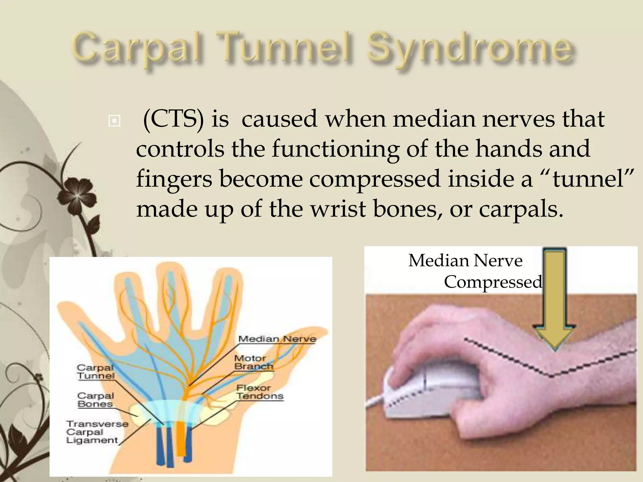     (CTS) is caused when median nerves that
    controls the functioning of the hands and
    fingers become compressed inside a “tunnel”
    made up of the wrist bones, or carpals.
                                  Median Nerve
                                     Compressed




             Free Powerpoint Templates            Page 12
 