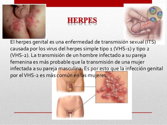 Herpes on palm of hand - Herpes - MedHelp