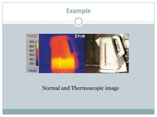 Example

Normal and Thermoscopic image

 