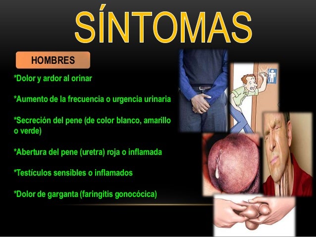 Uprozhnenie para aumentar el miembro
