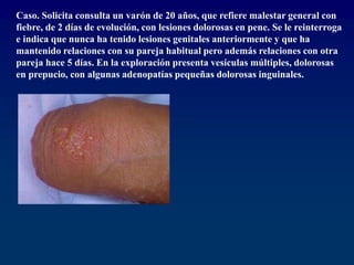 Caso. Solicita consulta un varón de 20 años, que refiere malestar general con
fiebre, de 2 días de evolución, con lesiones dolorosas en pene. Se le reinterroga
e indica que nunca ha tenido lesiones genitales anteriormente y que ha
mantenido relaciones con su pareja habitual pero además relaciones con otra
pareja hace 5 días. En la exploración presenta vesículas múltiples, dolorosas
en prepucio, con algunas adenopatías pequeñas dolorosas inguinales.
 