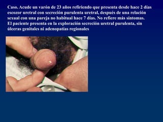 Caso. Acude un varón de 23 años refiriendo que presenta desde hace 2 días
escozor uretral con secreción purulenta uretral, después de una relación
sexual con una pareja no habitual hace 7 días. No refiere más síntomas.
El paciente presenta en la exploración secreción uretral purulenta, sin
úlceras genitales ni adenopatías regionales
 