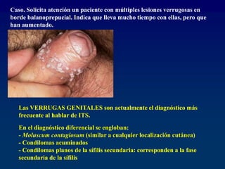 Caso. Solicita atención un paciente con múltiples lesiones verrugosas en
borde balanoprepucial. Indica que lleva mucho tiempo con ellas, pero que
han aumentado.
Las VERRUGAS GENITALES son actualmente el diagnóstico más
frecuente al hablar de ITS.
En el diagnóstico diferencial se engloban:
- Moluscum contagiosum (similar a cualquier localización cutánea)
- Condilomas acuminados
- Condilomas planos de la sífilis secundaria: corresponden a la fase
secundaria de la sífilis
 