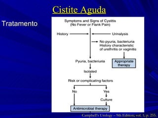 Cistite Aguda Tratamento Campbell’s Urology – 9th Edition; vol. 1; p. 255. 