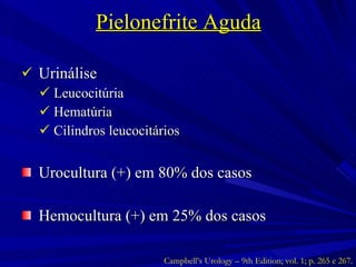 Pielonefrite Aguda Urinálise Leucocitúria Hematúria Cilindros leucocitários Urocultura (+) em 80% dos casos Hemocultura (+) em 25% dos casos Campbell’s Urology – 9th Edition; vol. 1; p. 265 e 267. 