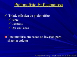Pielonefrite Enfisematosa Tríade clássica de pielonefrite Febre Calafrios Dor em flanco Pneumatúria em casos de invasão para sistema coletor Campbell’s Urology – 9th Edition; vol. 1; p. 271 e 272. 