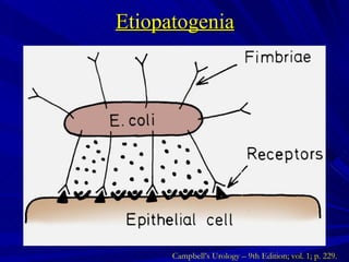 Etiopatogenia Campbell’s Urology – 9th Edition; vol. 1; p. 229. 