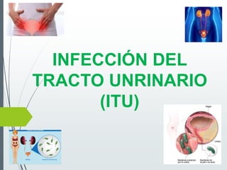 INFECCIÓN DEL
TRACTO UNRINARIO
(ITU)
 
