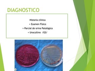 DIAGNOSTICO
Historia clínica
+ Examen Físico
+ Parcial de orina Patológico
+ Urocultivo /GS/
 