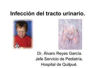 Infección del tracto urinario. Dr. Álvaro Reyes García. Jefe Servicio de Pediatría. Hospital de Quilpué. 