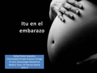 Rafael Rubio Saavedra
Universidad Privada Antenor Orrego
XI ciclo, Ginecología-Obstetricia
Medico Tutor: Dr Hernan Ramal
2016-II
 