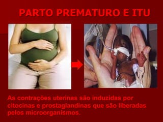 PARTO PREMATURO E ITU
As contrações uterinas são induzidas por
citocinas e prostaglandinas que são liberadas
pelos microorganismos.
 