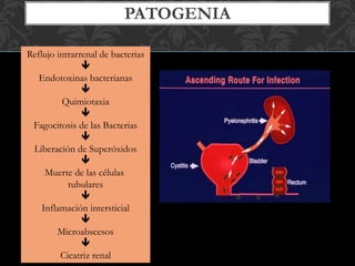 PATOGENIA
Reflujo intrarrenal de bacterias

Endotoxinas bacterianas

Quimiotaxia

Fagocitosis de las Bacterias

Liberación de Superóxidos

Muerte de las células
tubulares

Inflamación intersticial

Microabscesos

Cicatriz renal
 