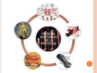 La primera prótesis de
                                            miembro superior , data del
                                                año 2000 a C, fue
                                            encontrada en una momia
                                                     egipcia.




   En el siglo xx se
emplean el cuero, los                                                                     Durante la segunda
polímeros naturales y                                                                        Guerra Púnica
   la madera en la                                                                          Marcus Sergius,
     fabricación de                                                                      fabricó una mano de
 prótesis, al igual que                                                                   hierro para él , ésta
los resortes, siendo el                                                                    es la primer mano
 modelo de Peter beil
  el más importante
                                             RESEÑA                                            registrada.

                                            HISTORICA
                                              DE LA
                                            PROTESIS


                     El medico militar
                                                                          en 1400 se fabricó la
                    francés Ambroise
                                                                          mano de alt-Ruppin,
                   Paré en el siglo XVI
                                                                          construida de hierro,
                   desarrollo el primer
                                                                            constaba de un
                   brazo artificial móvil
                                                                            pulgar rigido en
                      a nivel del codo
                                                                           oposición y dedos
                    llamado " Le Petit
                                                                                flexibles
                          Loraine"
 