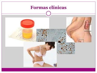 Formas clínicas
 