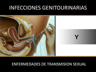 INFECCIONES GENITOURINARIAS
ENFERMEDADES DE TRANSMISION SEXUAL
Y
 