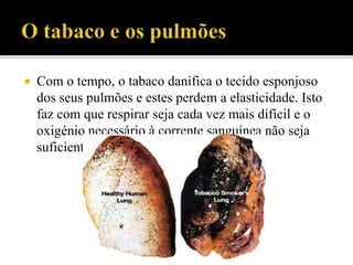  Com o tempo, o tabaco danifica o tecido esponjoso
dos seus pulmões e estes perdem a elasticidade. Isto
faz com que respirar seja cada vez mais difícil e o
oxigénio necessário à corrente sanguínea não seja
suficiente.
 