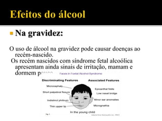  Na gravidez:
O uso de álcool na gravidez pode causar doenças ao
recém-nascido.
Os recém nascidos com síndrome fetal alcoólica
apresentam ainda sinais de irritação, mamam e
dormem pouco.
 