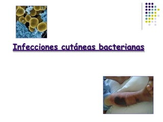 Infecciones cutáneas bacterianas
 