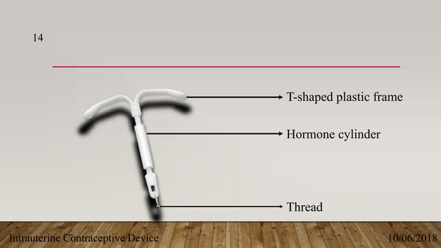 Intrauterine device (IUD)