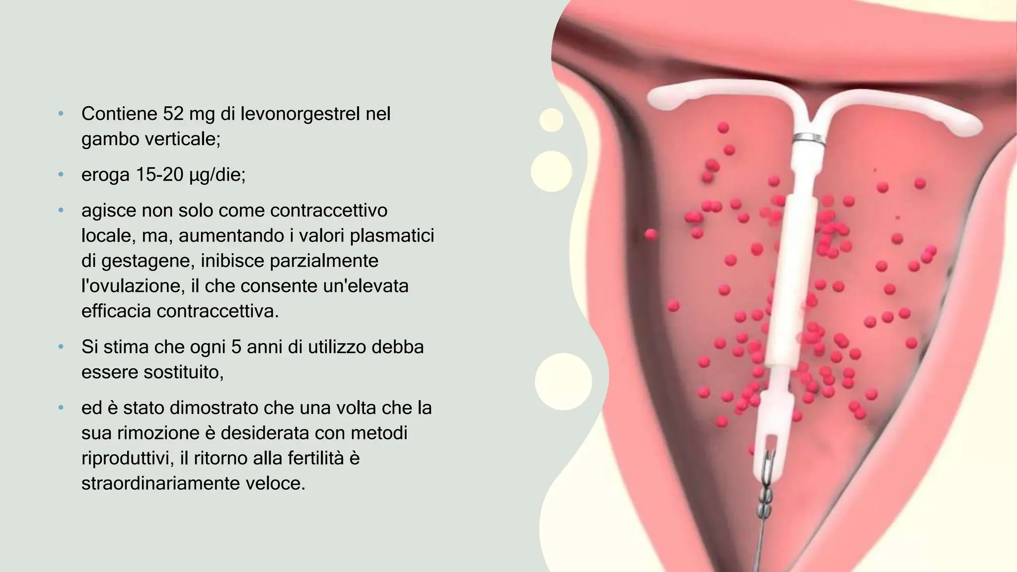 Iud Rame IUD Ormonale, Intra Uterine Device Spirale IUD | PPT