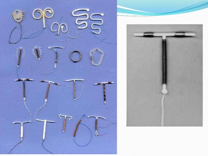 Intra Uterine Devices