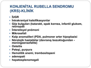 KONJENİTAL RUBELLA SENDROMU
(KRS)-KLİNİK
 İUGR
 İntrakraniyal kalsifikasyonlar
 Göz bulguları (katarakt, opak kornea, infantil glukom,
retinopati
 İnterstisyel pnömoni
 Mikrosefali
 Kalp anomalileri (PDA, pulmoner arter hipoplazisi
 Nörolojik hastalıklar (davranış bozukluğundan -
meningoensefalite)
 Osteitis
 Peteşi, purpura
 Hemolitik anemi, trombositopeni
 adenopati
 hepatosplenomegali
 