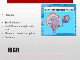 IUGR
• Placental
• Small placenta
• Fetal/Placental weight ratio
>10
• Placental chronic abruption
• Post-term
 