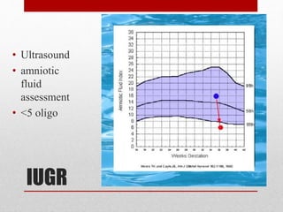 IUGR
• Ultrasound
• amniotic
fluid
assessment
• <5 oligo
 