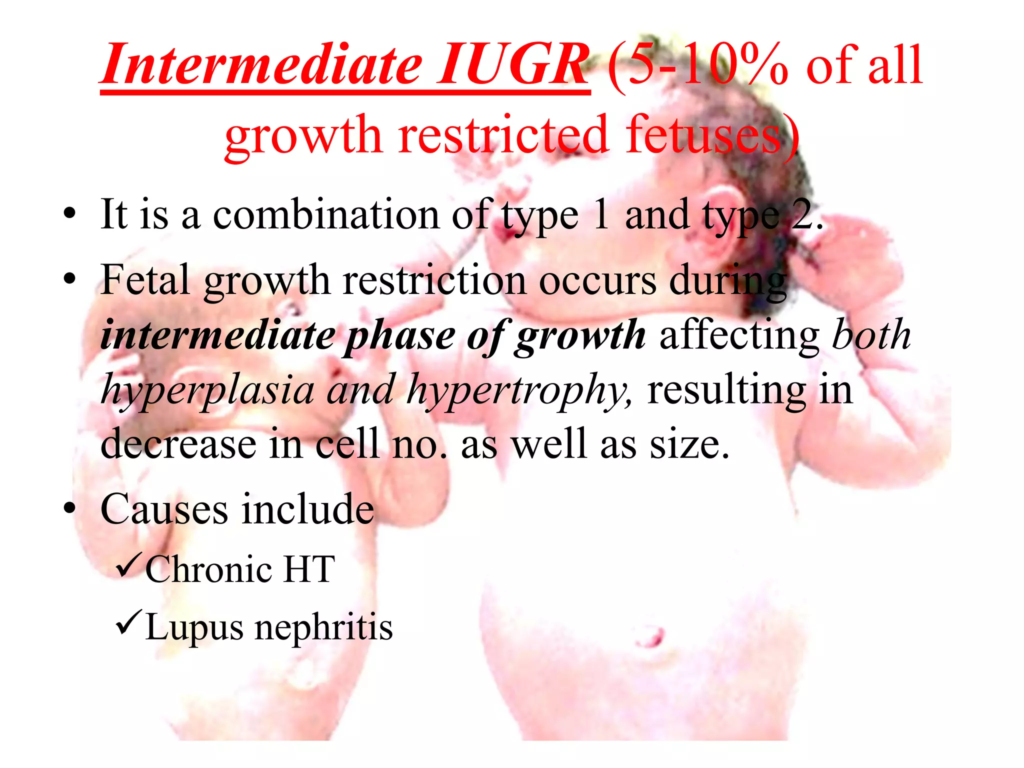 Intermediate IUGR (5-10% of all 
growth restricted fetuses) 
• It is a combination of type 1 and type 2. 
• Fetal growth restriction occurs during 
intermediate phase of growth affecting both 
hyperplasia and hypertrophy, resulting in 
decrease in cell no. as well as size. 
• Causes include 
Chronic HT 
Lupus nephritis 
 