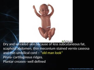 Dry and wrinkled skin because of less subcutaneous fat,
scaphoid abdomen, thin meconium stained vernix caseosa
and thin umbilical cord – “old man look”
Pinna- cartilaginous ridges.
Plantar creases- well defined
 