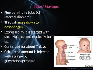 Tube/ Gavage:
• Fine polythene tube 0.5 mm
internal diameter
• Through nose down to
oesophagus
• Expressed milk is started with
small volume and gradually build
up.
• Continued for about 7 days
• Calculated amount is injected
with syringe by
gravitation/pressure
 