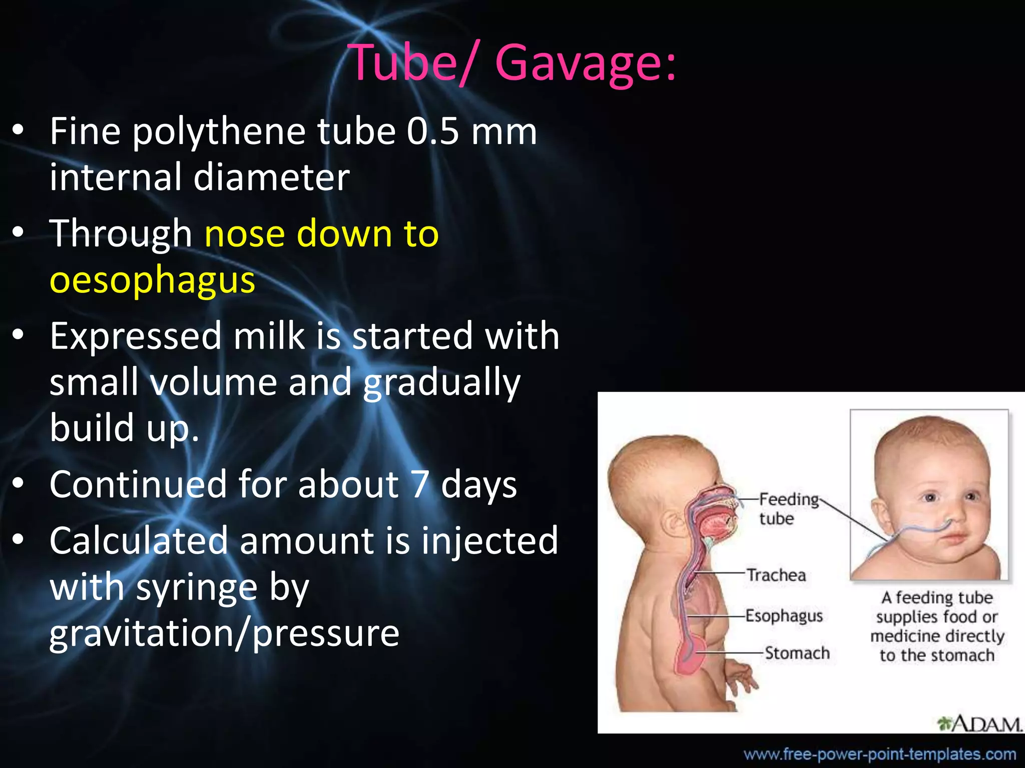 Tube/ Gavage:
• Fine polythene tube 0.5 mm
internal diameter
• Through nose down to
oesophagus
• Expressed milk is started with
small volume and gradually
build up.
• Continued for about 7 days
• Calculated amount is injected
with syringe by
gravitation/pressure
 