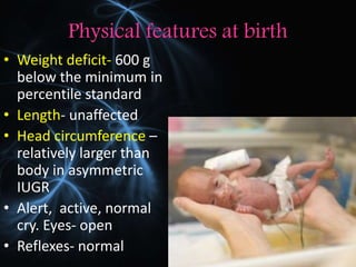 Physical features at birth
• Weight deficit- 600 g
below the minimum in
percentile standard
• Length- unaffected
• Head circumference –
relatively larger than
body in asymmetric
IUGR
• Alert, active, normal
cry. Eyes- open
• Reflexes- normal
 