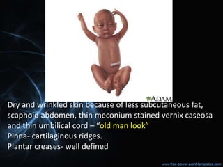 Dry and wrinkled skin because of less subcutaneous fat,
scaphoid abdomen, thin meconium stained vernix caseosa
and thin umbilical cord – “old man look”
Pinna- cartilaginous ridges.
Plantar creases- well defined
 