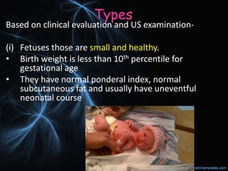 Types
Based on clinical evaluation and US examination-
(i) Fetuses those are small and healthy.
• Birth weight is less than 10th percentile for
gestational age
• They have normal ponderal index, normal
subcutaneous fat and usually have uneventful
neonatal course
 
