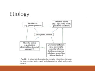 Etiology
 